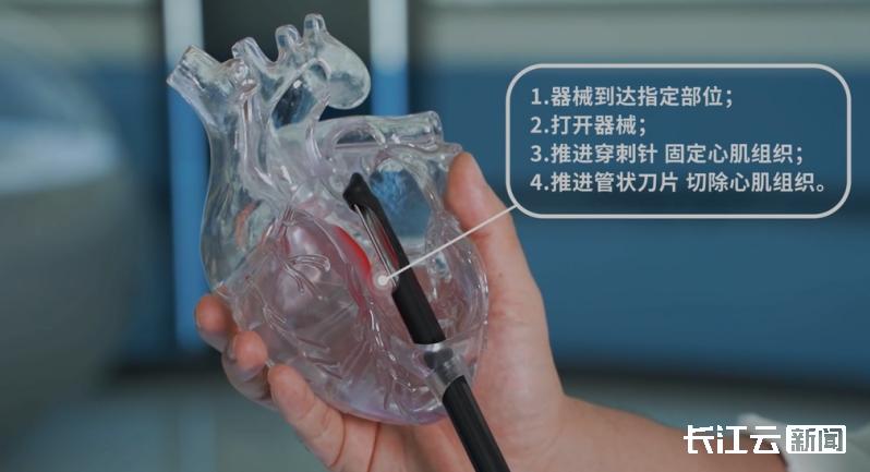 全球前沿技术云集 武汉大健康产业缘何拥有超强吸引力 全球前沿技术云集 武汉大健康产业缘何拥有超强吸引力